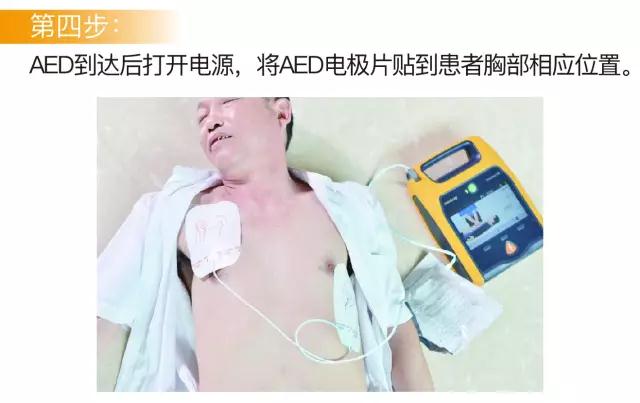 AED操作指南四